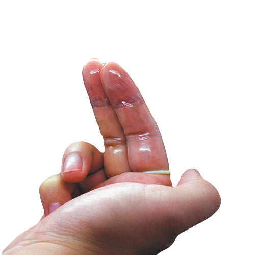 finger condom