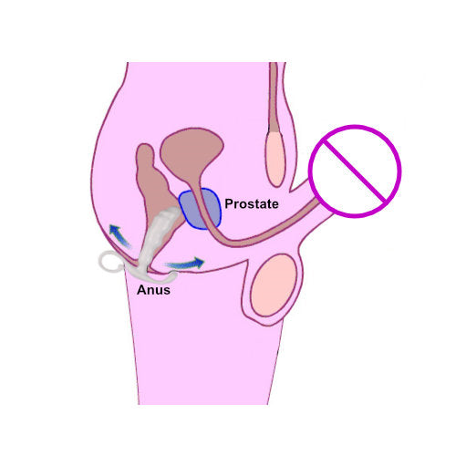 QY Prostate Stimulator Plug (M)